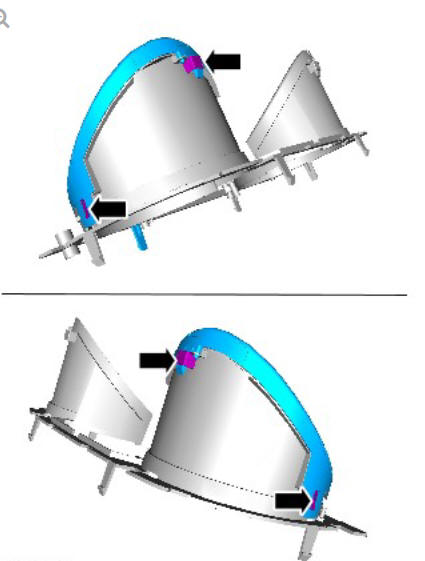 Instrument Cluster Lens (G1791763) / Removal and Installation